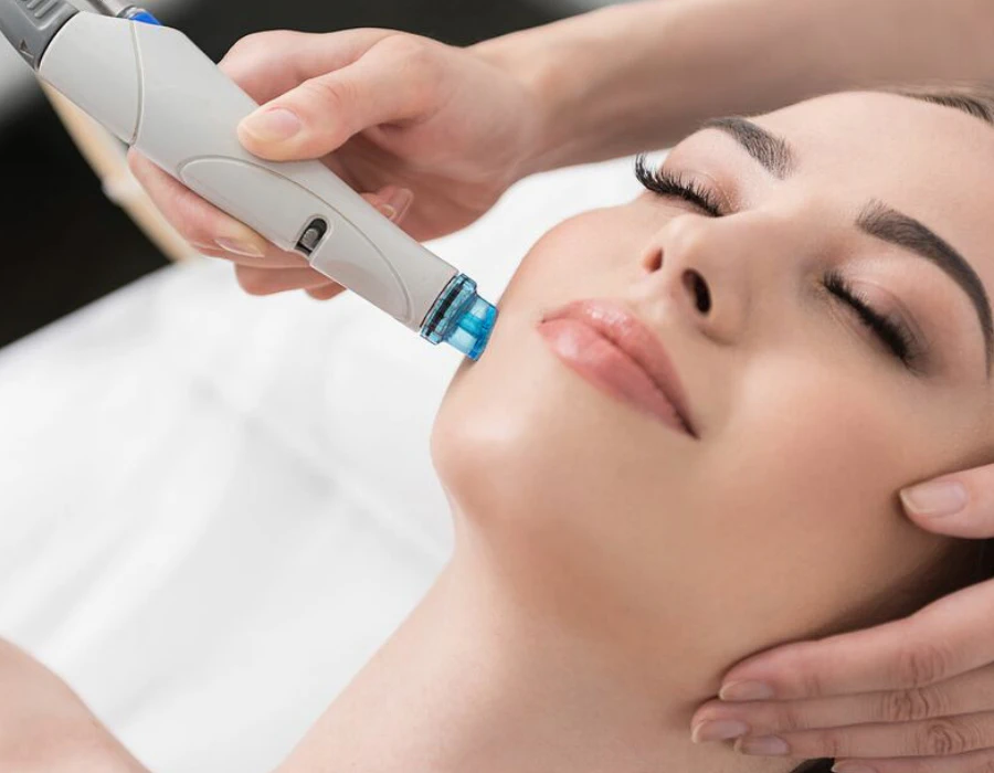 Hydrafacial treatment